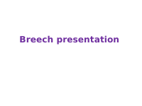 breeeeeeech presetation-3.pptx